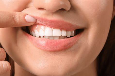 Melhor escova de dente eletrica para gengivas retraídas