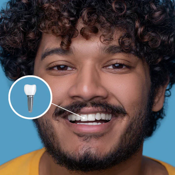 Por que evitar laticínios após um implante dentário?