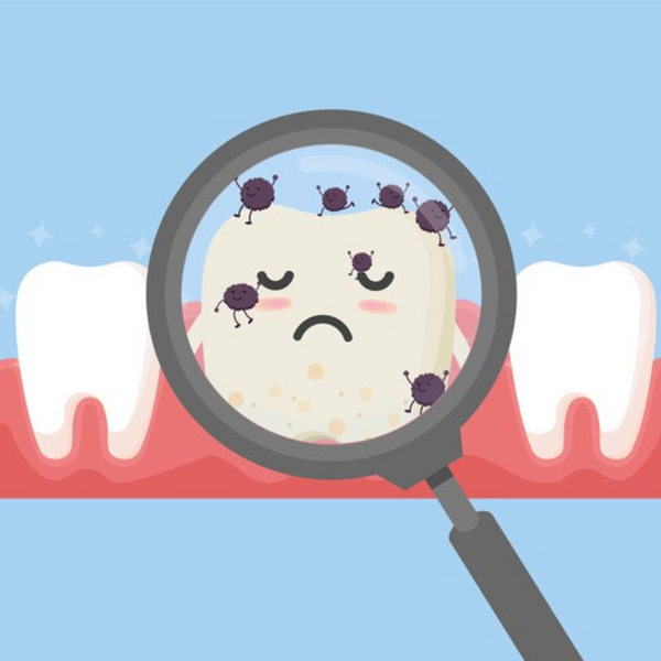 O Antibiótico Natural Mais Forte para Infecção Dentária: Remédios Eficazes e Prevenção